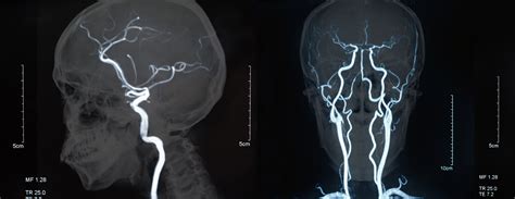 the villages magnetic resonance|Magnetic Resonance Angiography .